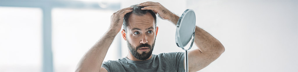 haaruitval-bij-mannen