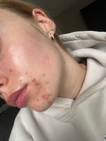 1309314_enhance_review_media_7955149 1309314_enhance_review_media_7955149