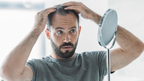 Help! Haaruitval bij mannen, wat doe je eraan? Help! Haaruitval bij mannen, wat doe je eraan?