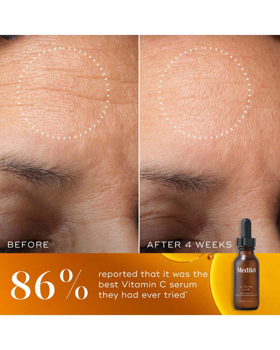 Lipid 14% Vitamin C Enhanced Radiance Serum