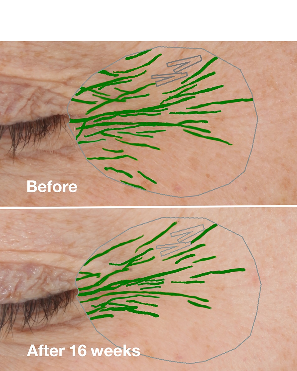 ANTI-AGING HYDRATERENDE CRÈME - DROGE HUID