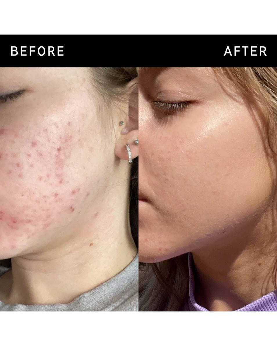 The Inkey List NIACINAMIDE SERUM NIACINAMIDE SERUM 30 ML 3