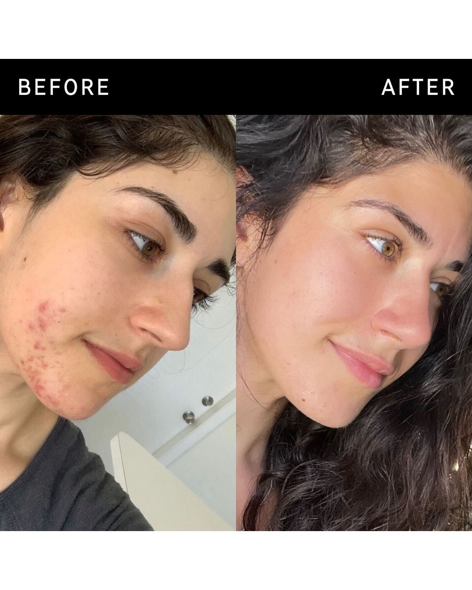 BARNSTEENZUUR BEHANDELING