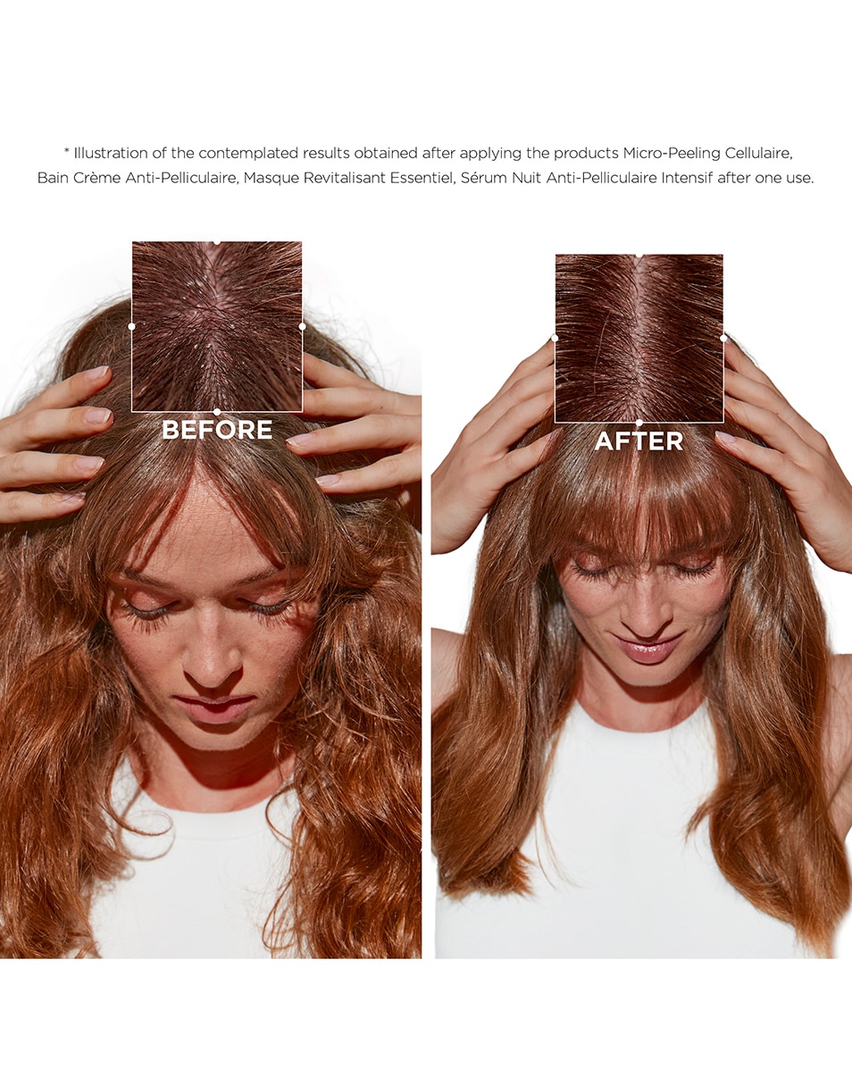 Micro-exfoliërende cellulaire anti-roos pre-shampoo verzorging