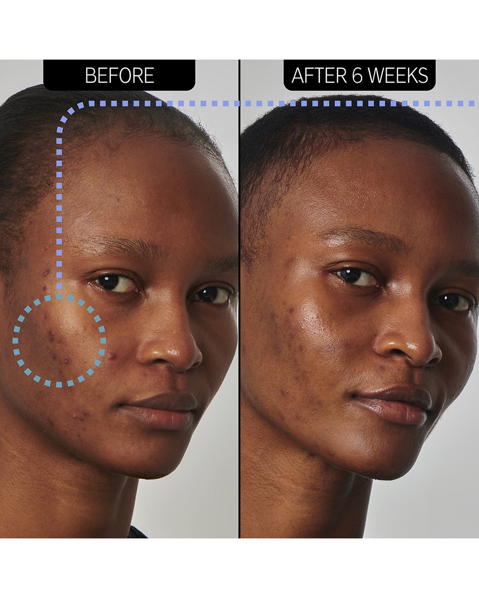 The Inkey List SUPERSOLUTIONS SUPERSOLUTIONS 20% NIACINAMIDE SERUM 30 ML 3