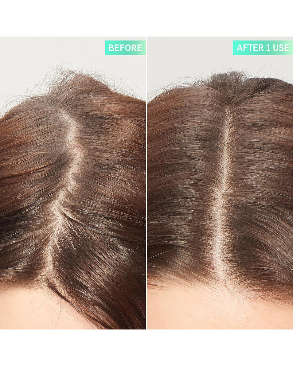 EXFOLIËRENDE HOOFDHUIDPEELING MET GLYCOLZUUR