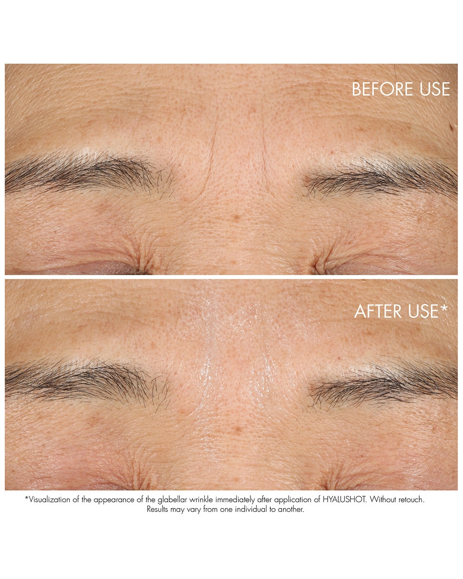 DIOR Capture Totale Hyalushot Corrector voor bestaande rimpels en 1e tekenen van rimpels 15 ML 3