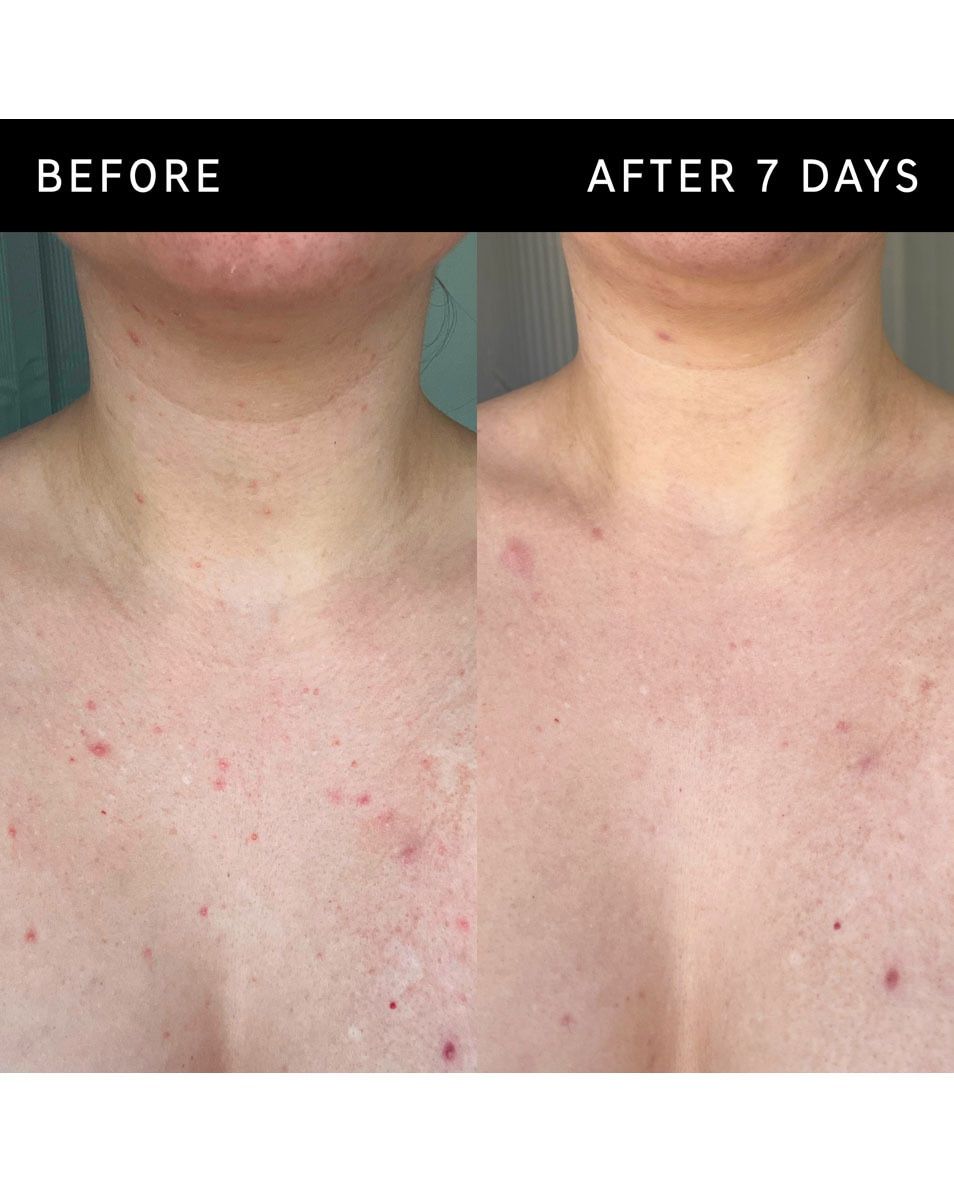 The Inkey List Body Care Exfoliërende bodystick met glycolzuur 45 G