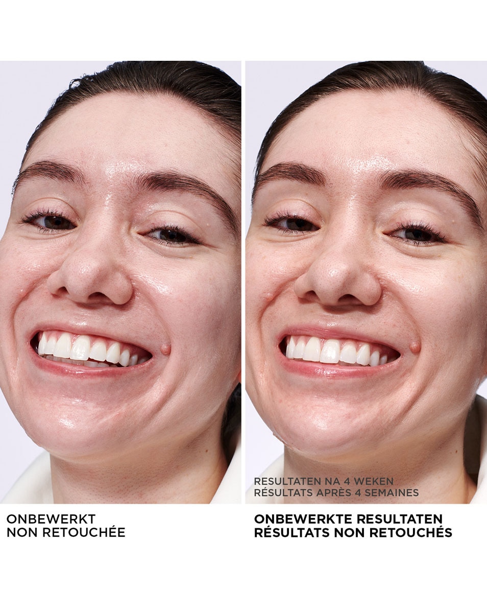 CONFIDENCE IN A CREAM OIL CONTROL