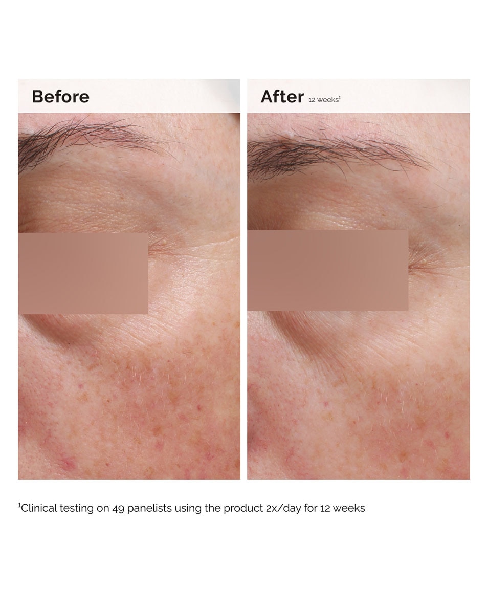 NIACINAMIDE 5% FACE & BODY EMULSION