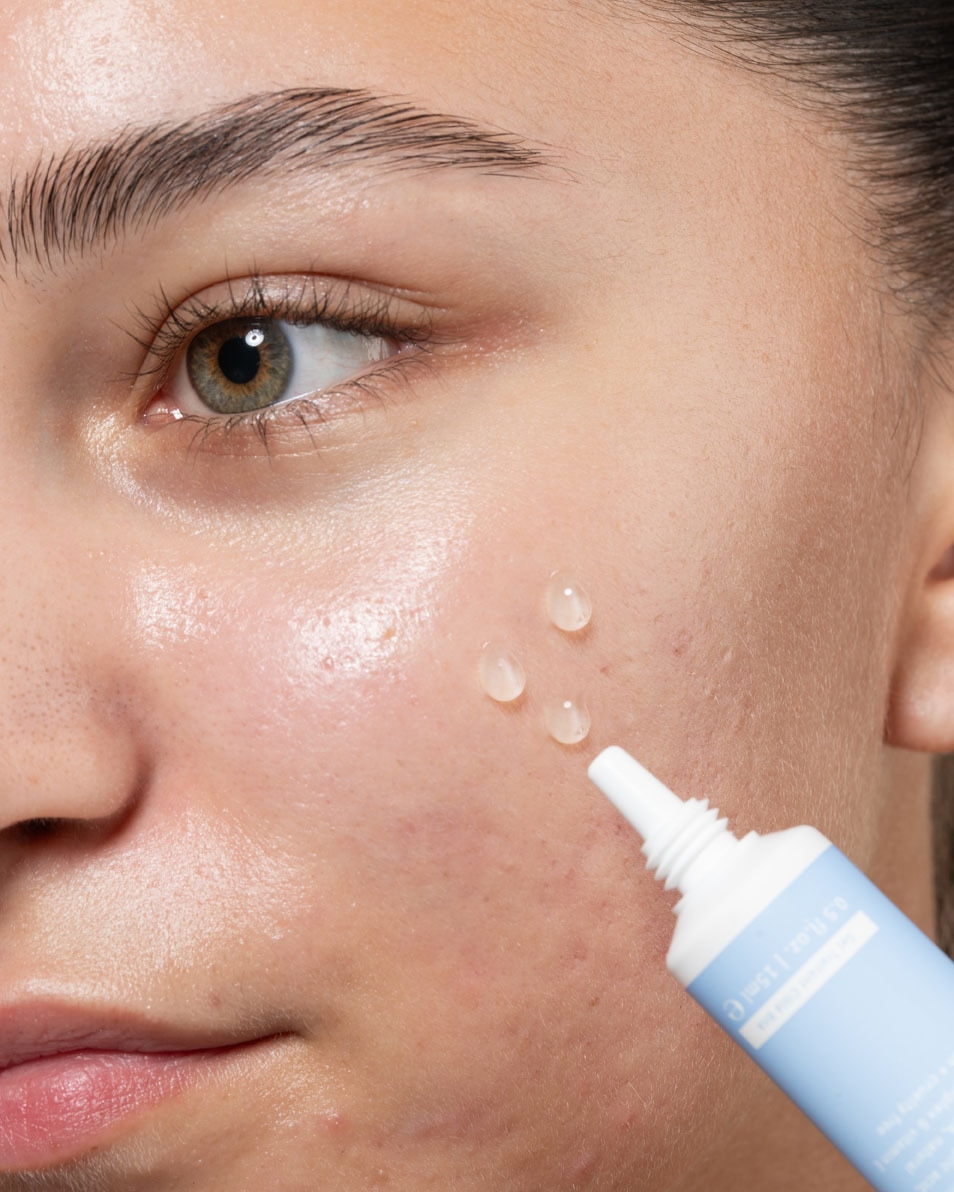 CLAY AND GLOW Spot treatment gel Gel 15 ML 3