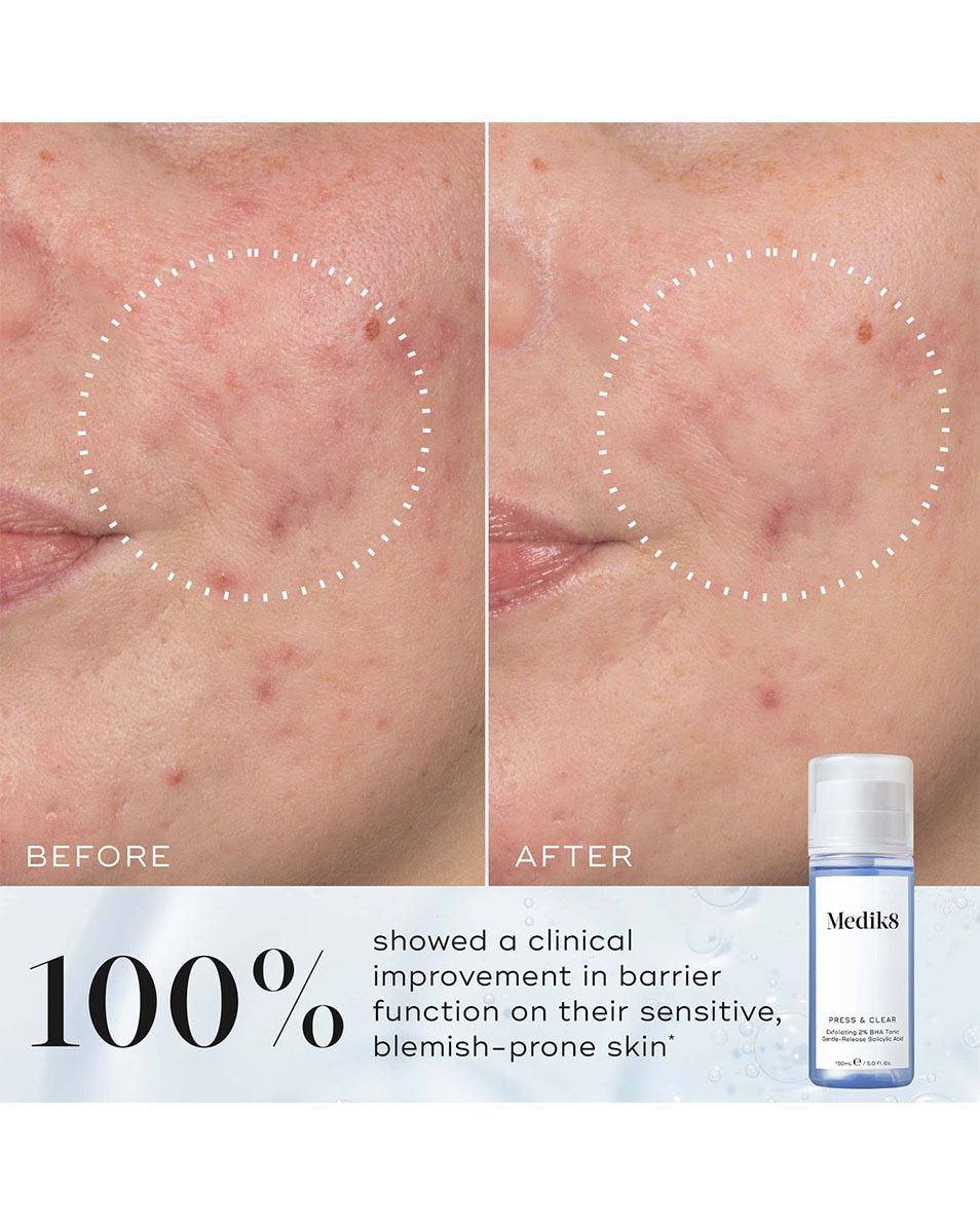 Exfoliating 2% BHA Tonic Gentle-Release Salicylic Acid