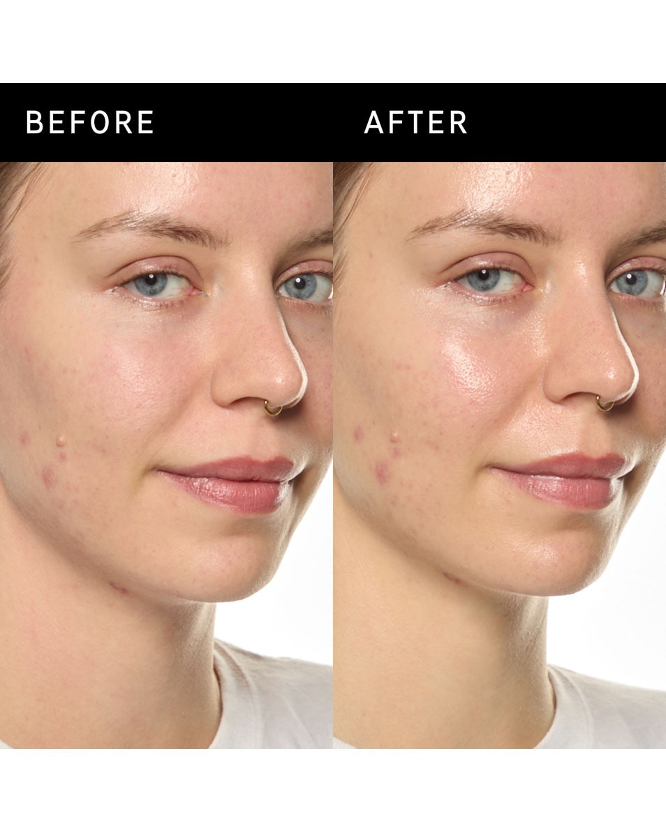 Hydro-barrièreserum met ectoïne