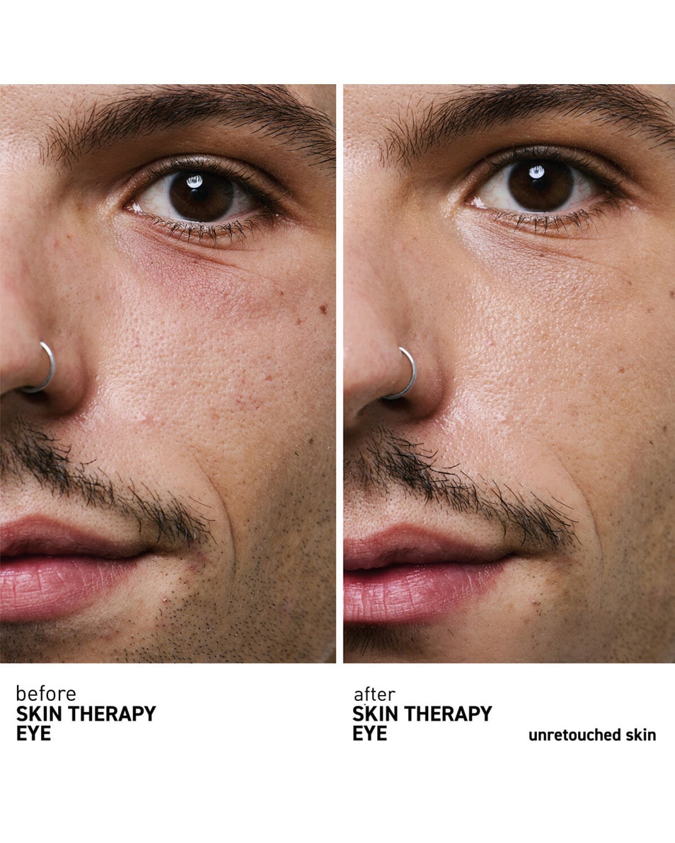 ERBORIAN Skin Therapy Eye Multi-perfectionerende oogcontourcrème 15 ML 3