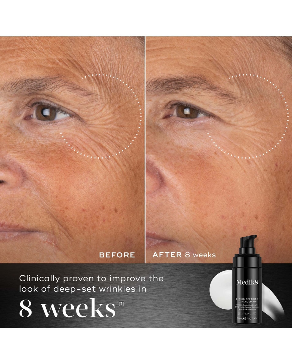 Wrinkle Reduction Serum