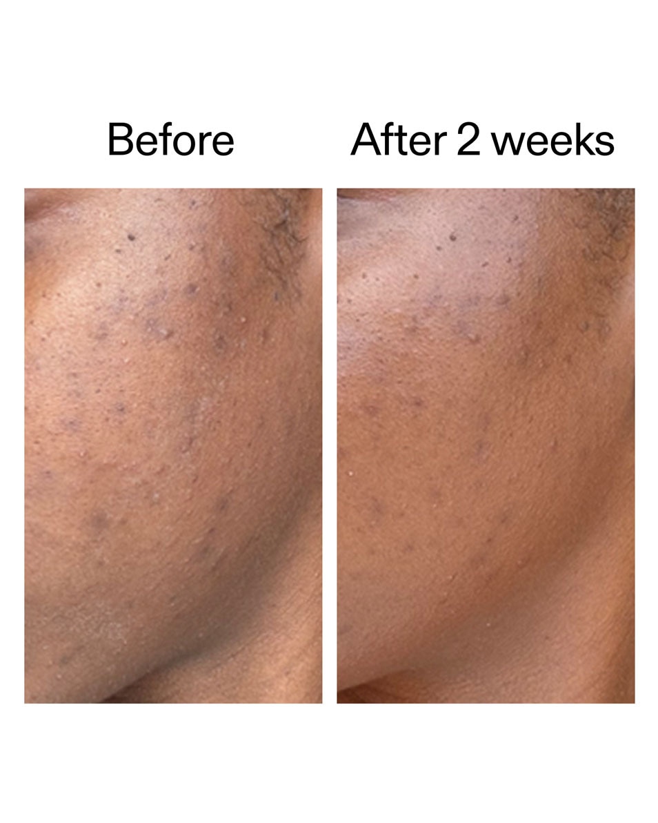 Coffret Soin Barrière Cutanée