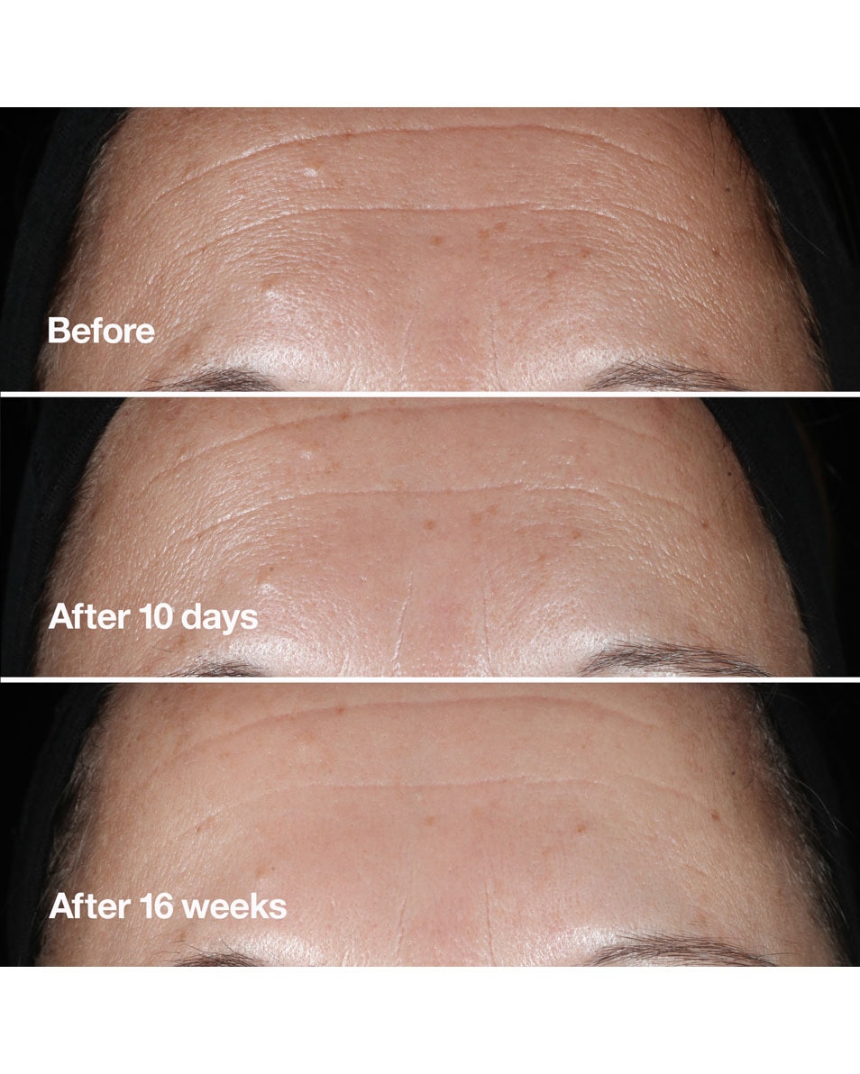 CLINIQUE SMART CLINICAL Anti-Wrinkle Correcting Serum 100 ML 3