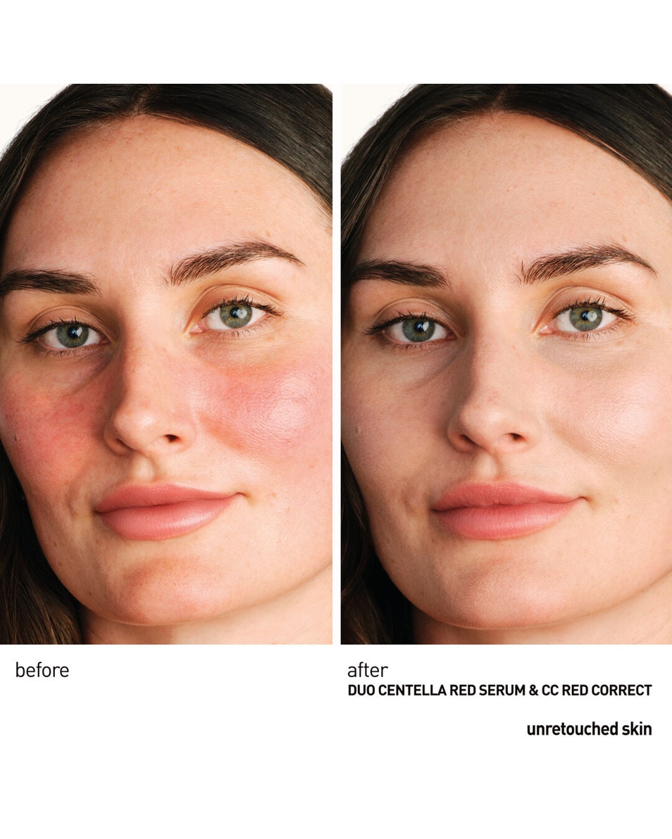 ERBORIAN CENTELLA RED SERUM Onmiddellijk kalmerend concentraat 30 ML 3