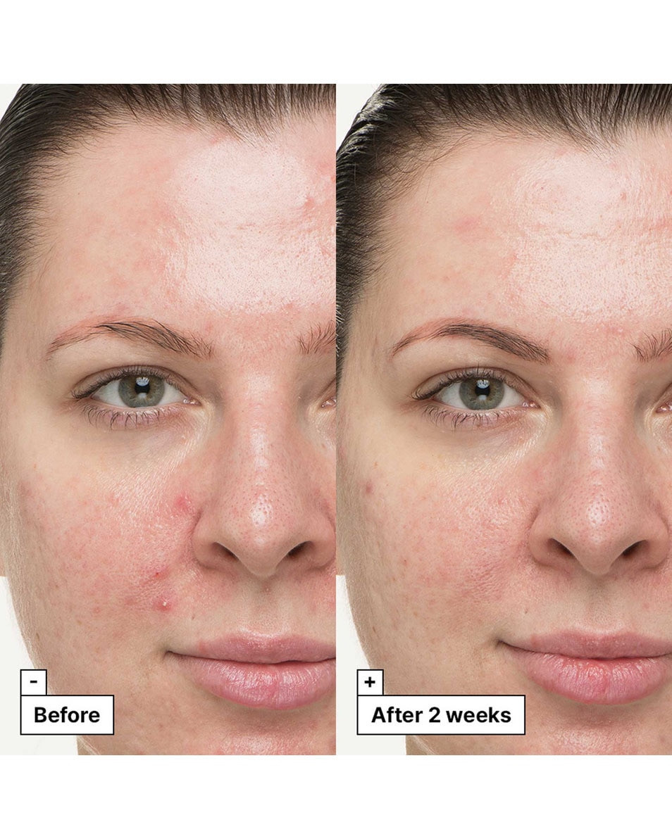 DR JART+ Cicapair Kalmerende Behandeling 30 ML 3