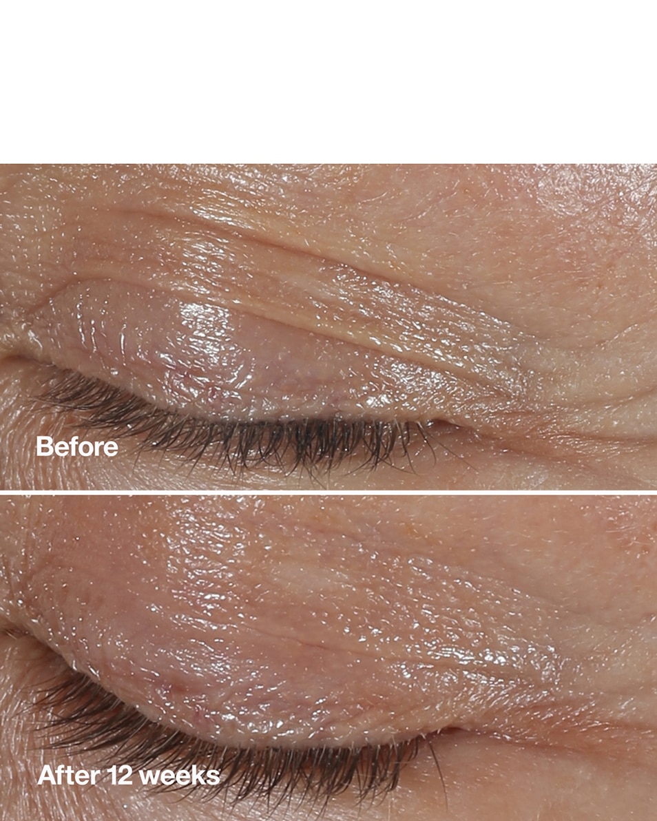 OOGCRÈME - ANTI-AGING & HYDRATEREND - VERMINDERT RIMPELS