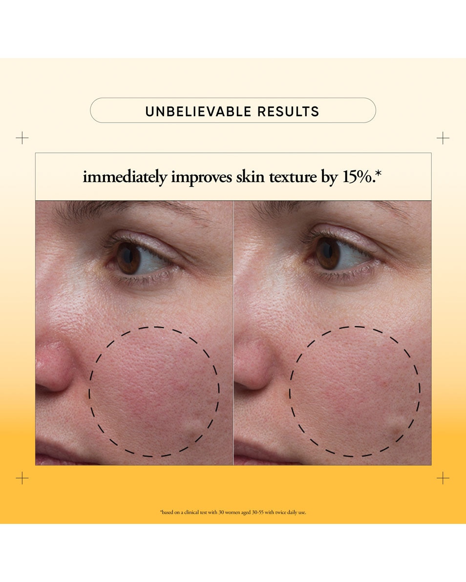 PHILOSOPHY MICRODELIVERY RESURFACING SOLUTION 150ML