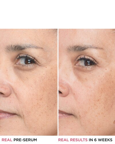 IT COSMETICS BYE BYE SERUM IT BYE BYE LINES HYALURONIC ACID SERUM 30 ML