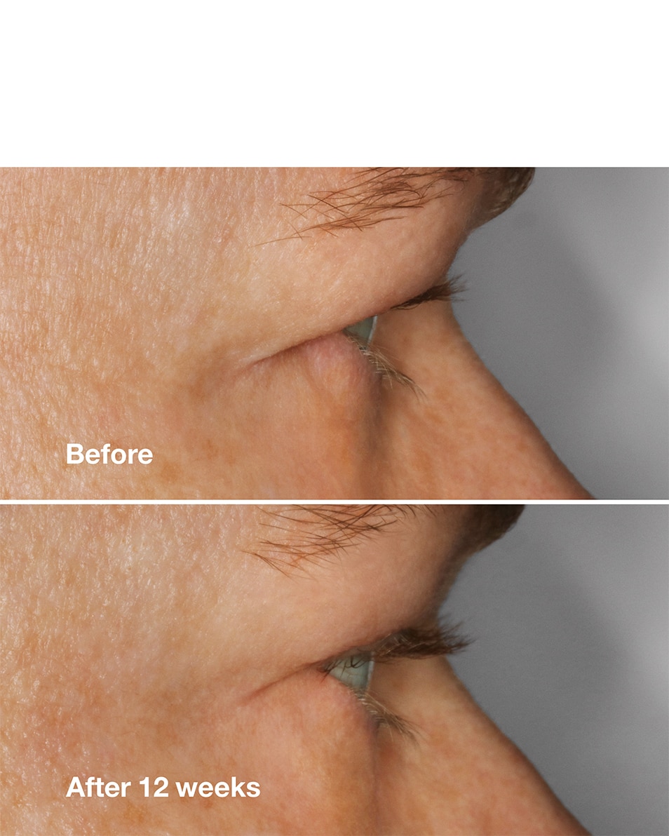 CLINIQUE HIGH IMPACT™ LASH AMPLIFYING SERUM WIMPERSERUM - VOOR LANGERE & VOLLERE WIMPERS 3 ML 4