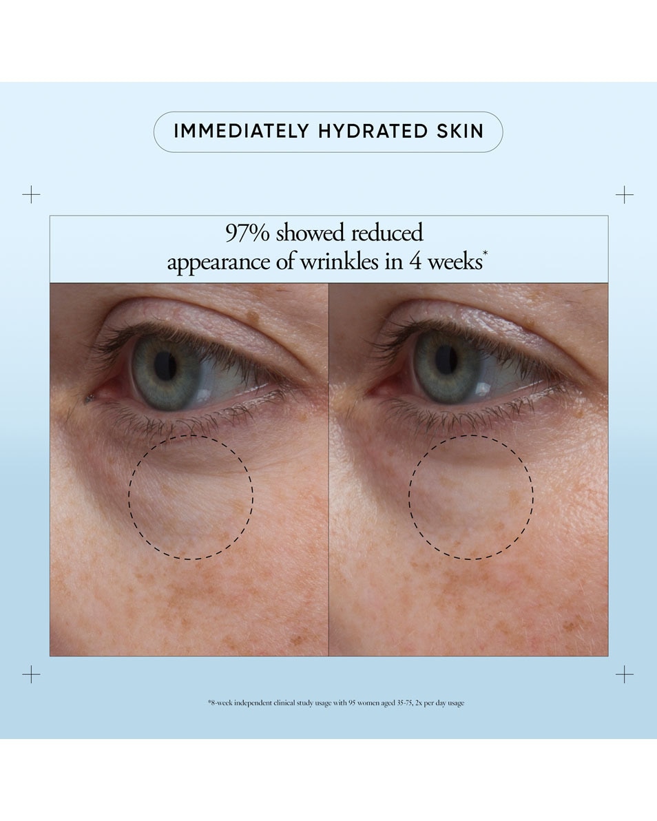 PHILOSOPHY RENEWED HOPE IN A JAR EYE REVIVAL SERUM-IN-CREAM 15 ML 4