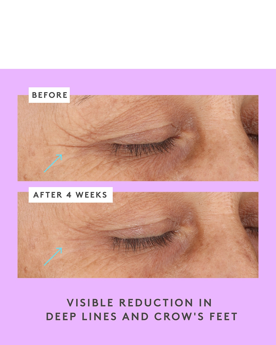 DRUNK ELEPHANT TREATMENT CERAMIGHTY™ AF EYE BALM 15 ML 4