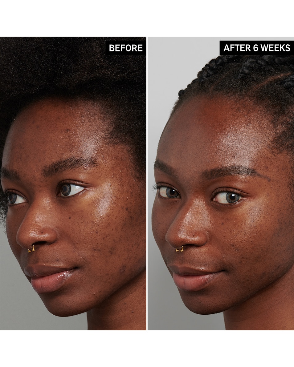 The Inkey List TRANEXAMIC ACID SERUM TRANEXAMINEZUUR SERUM 30 ML 4