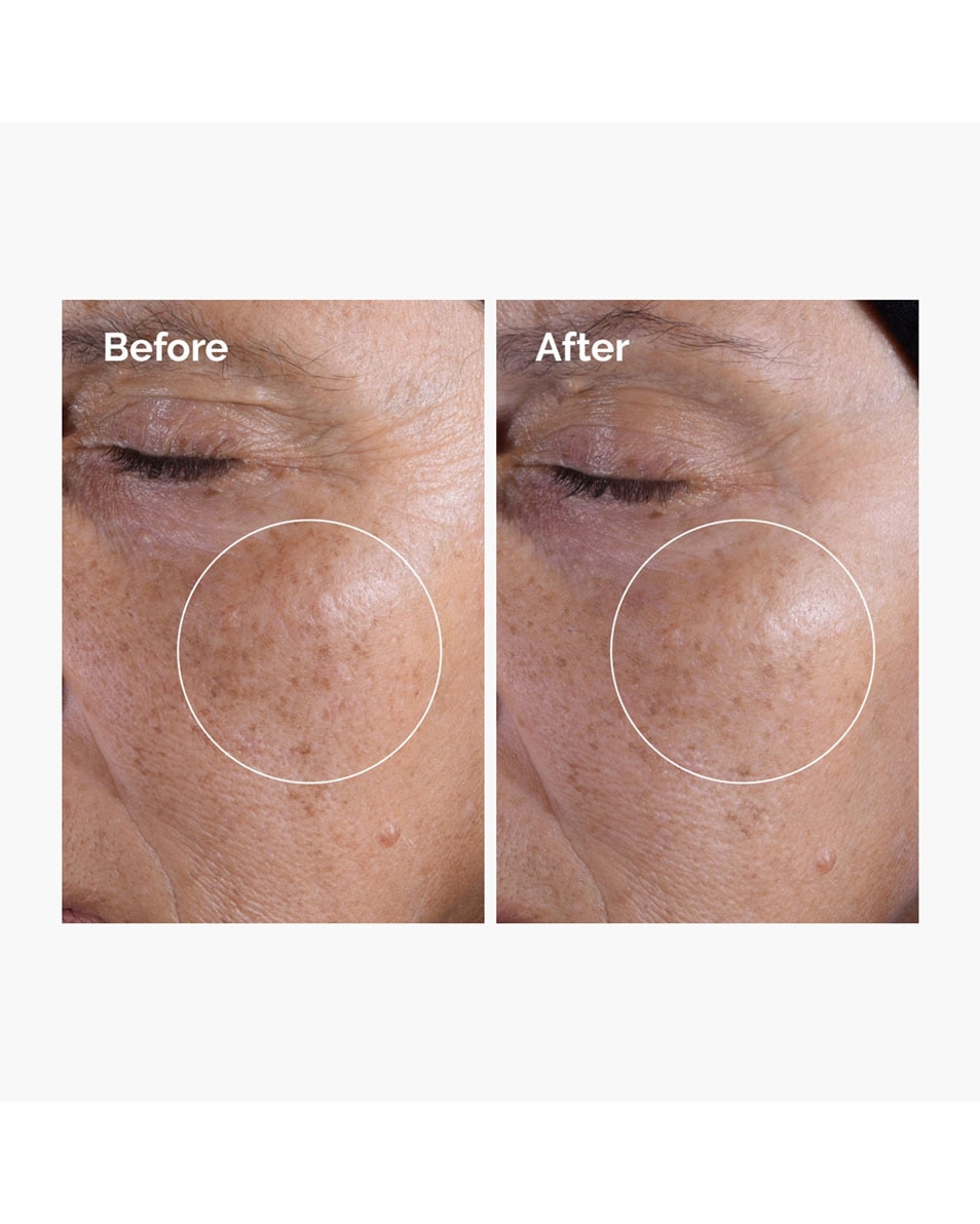 THE ORDINARY Toner Glycolic Acid 7% Exfoliating Toner 100 ML 4