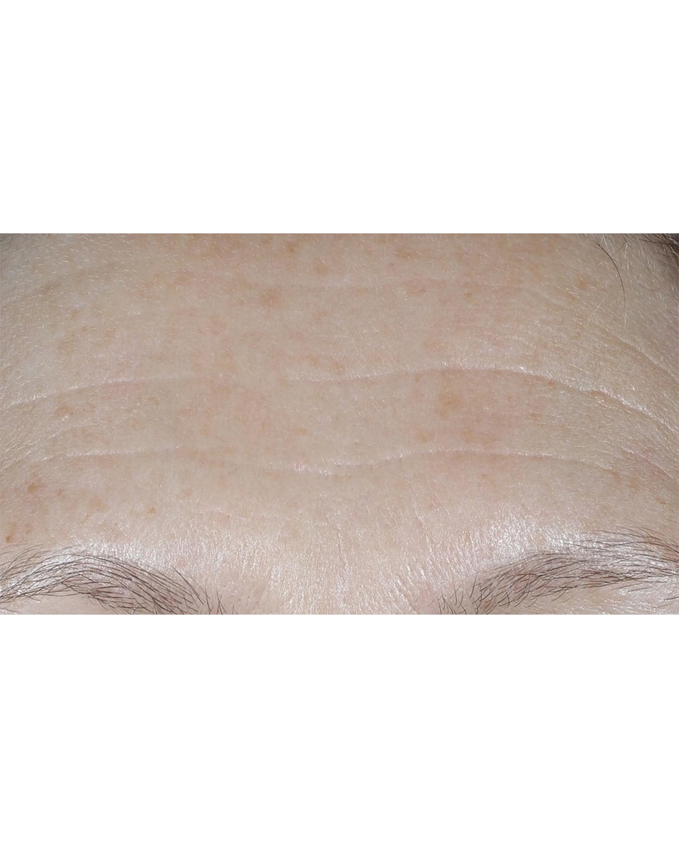 Hydraterende crème met SPF - anti-aging