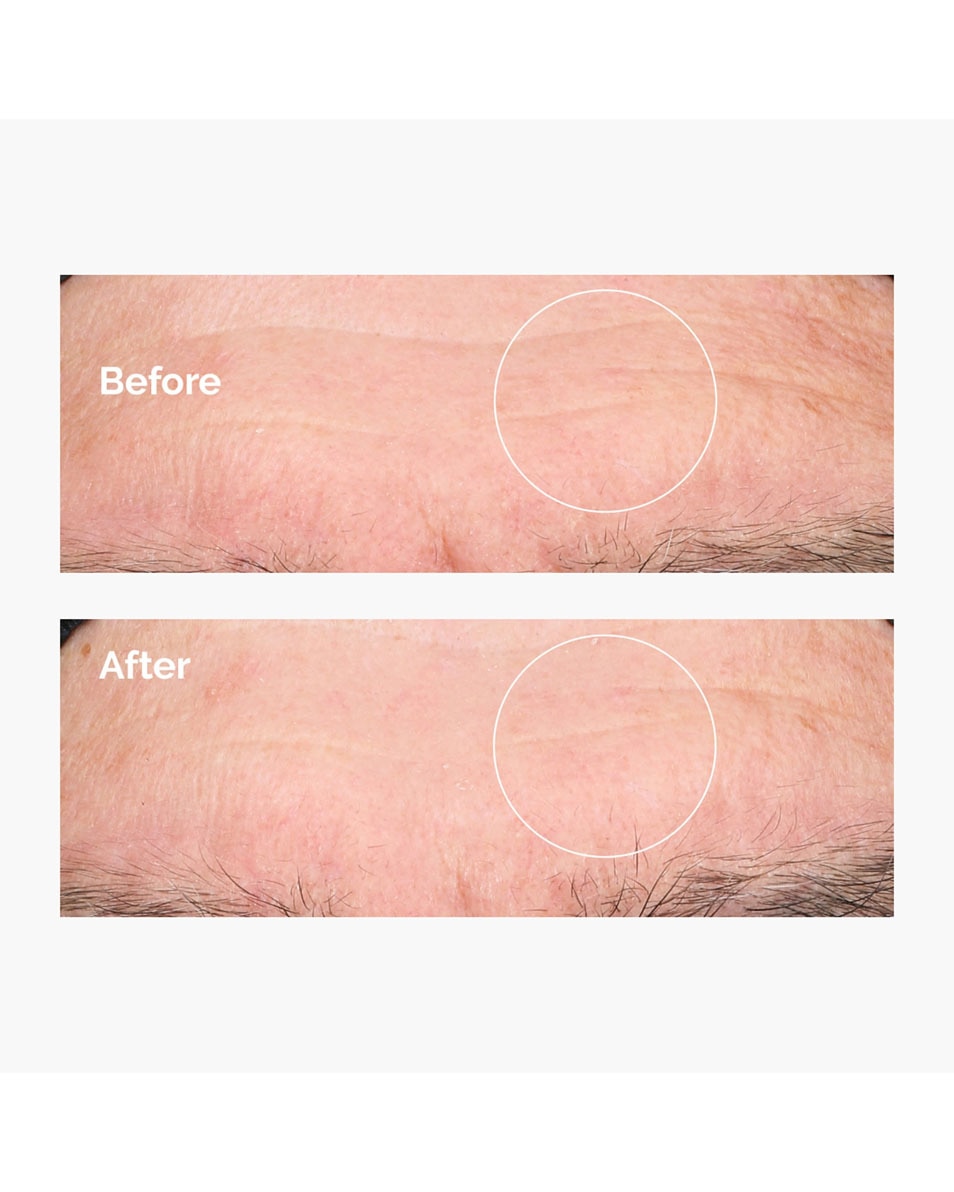 Hyaluronic Acid 2% + B5