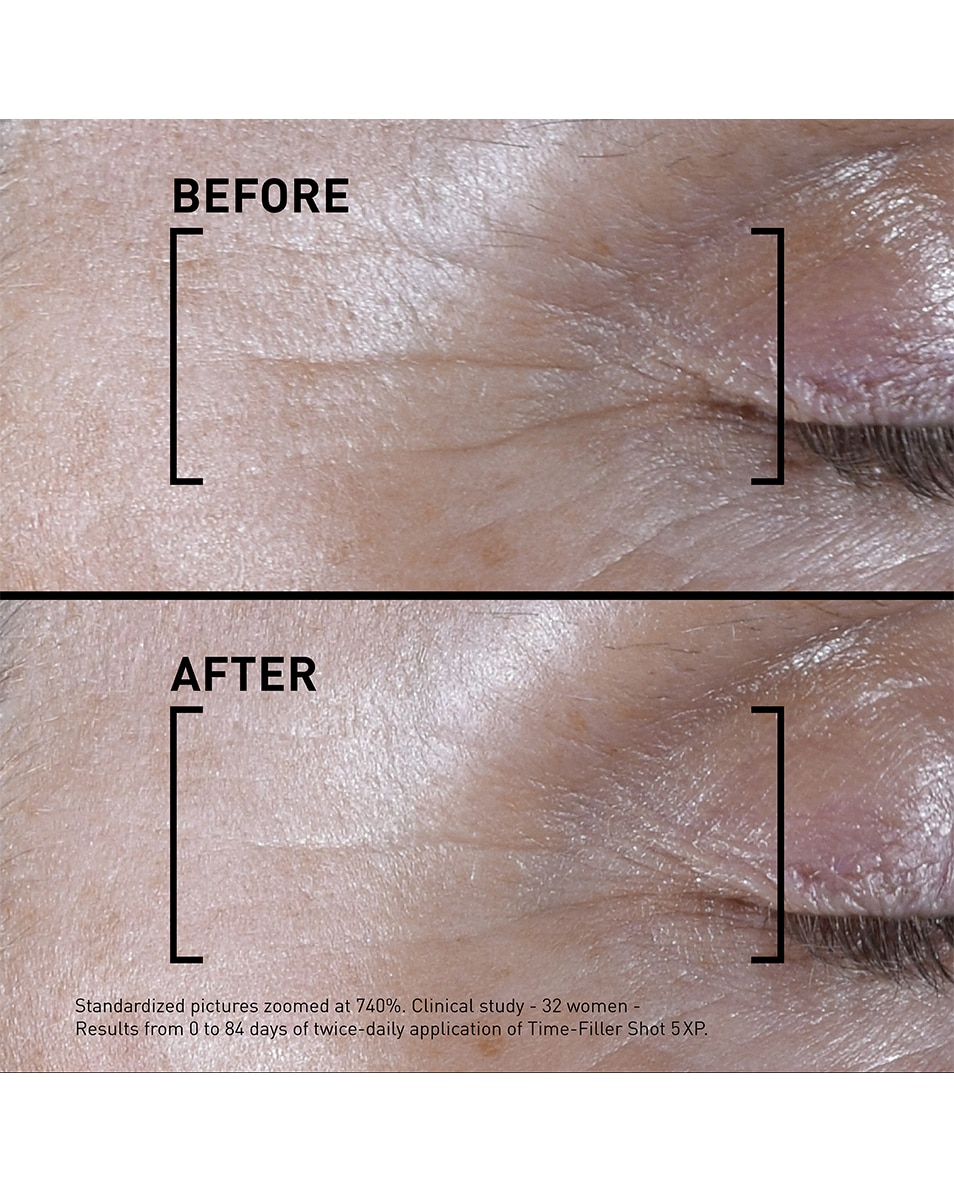 FILORGA SHOT 5XP Geconcentreerd serum - Correctie van zichtbare expressierimpels 15 ML 4