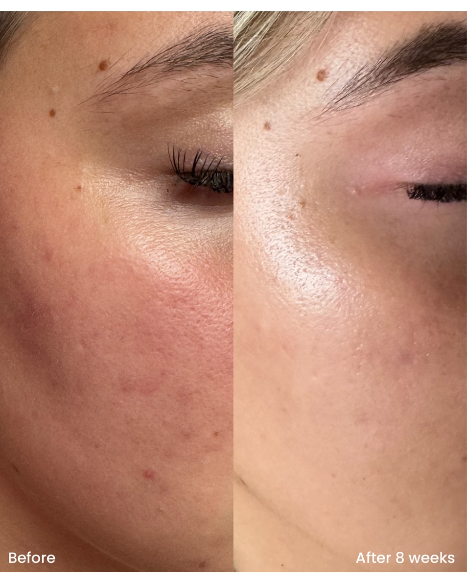 10% Niacinamide treatment serum