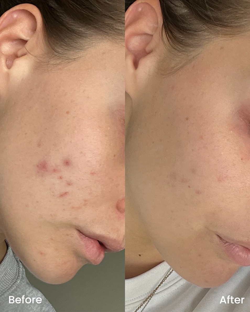 CLAY AND GLOW Spot treatment gel Gel 15 ML 4