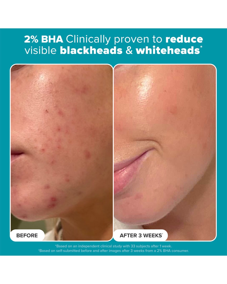 Paula's Choice SKIN PERFECTING SKIN PERFECTING 2% BHA Liquid Exfoliant 118 ML 4