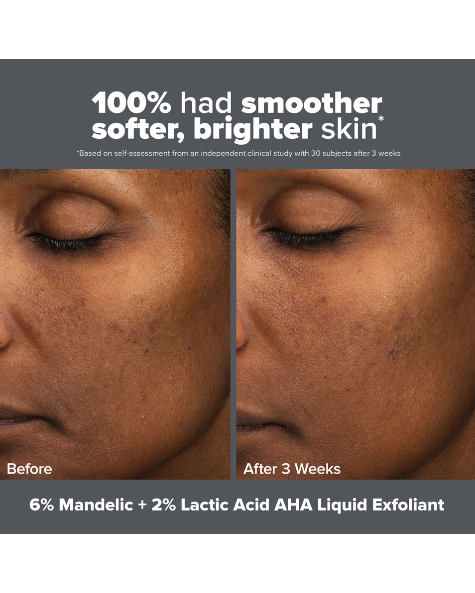 Paula's Choice SKIN PERFECTING SKIN PERFECTING 6% Mandelic Acid + 2% Lactic Acid AHA Liquid Exfoliant 88 ML