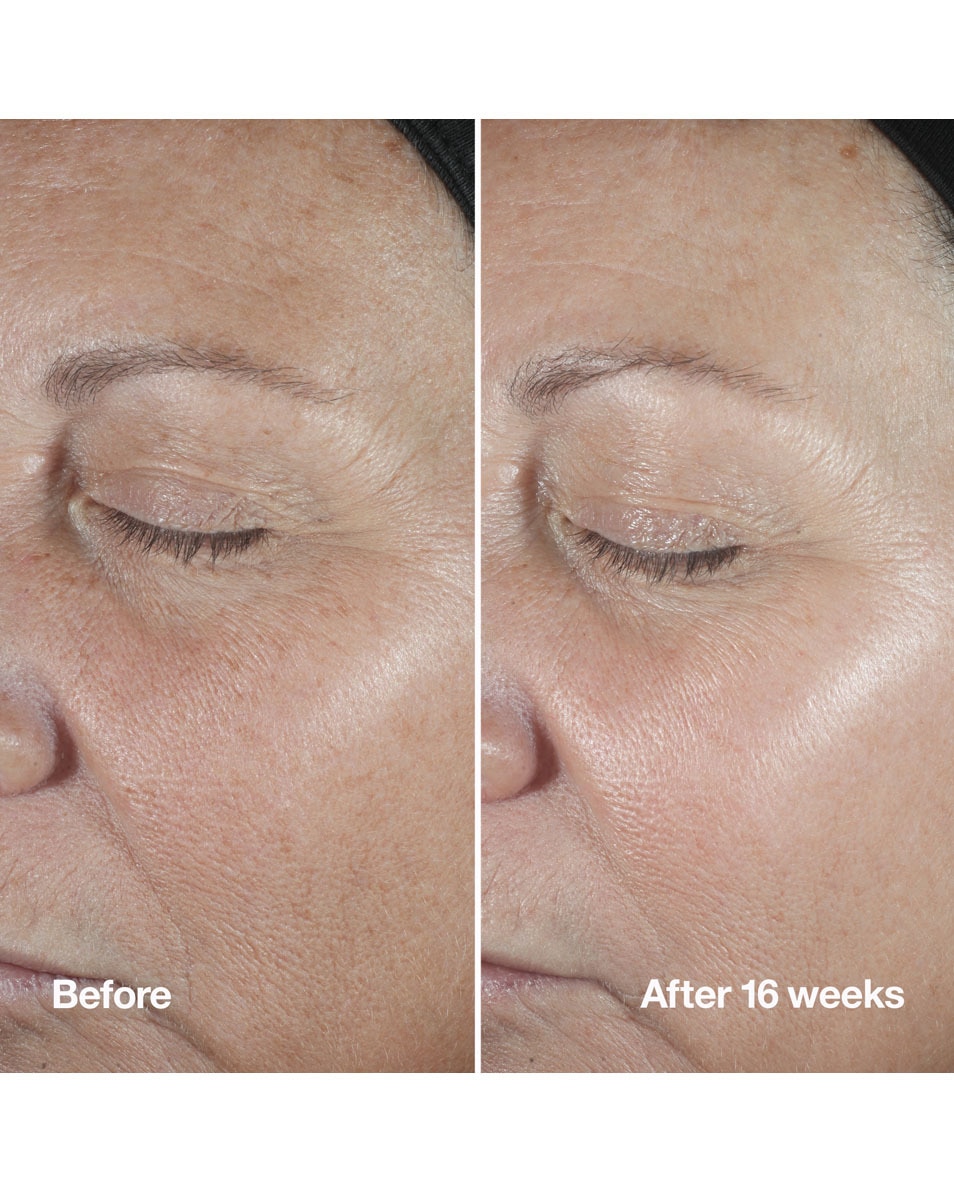 CLINIQUE SMART CLINICAL Anti-Wrinkle Correcting Serum 100 ML 4