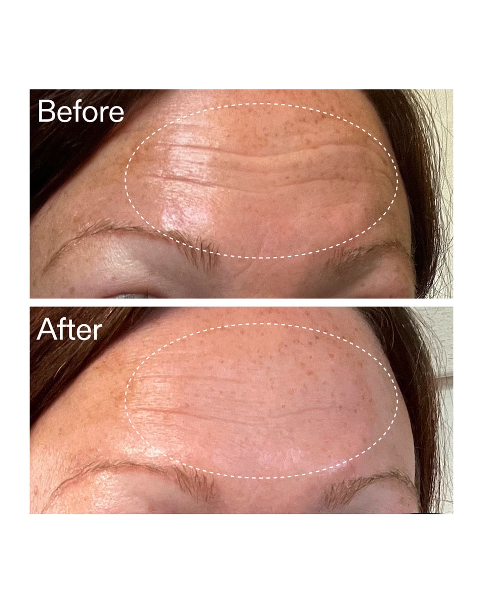 The Inkey List Starter Retinol Serum Retinol Serum voor Beginners 30 ML