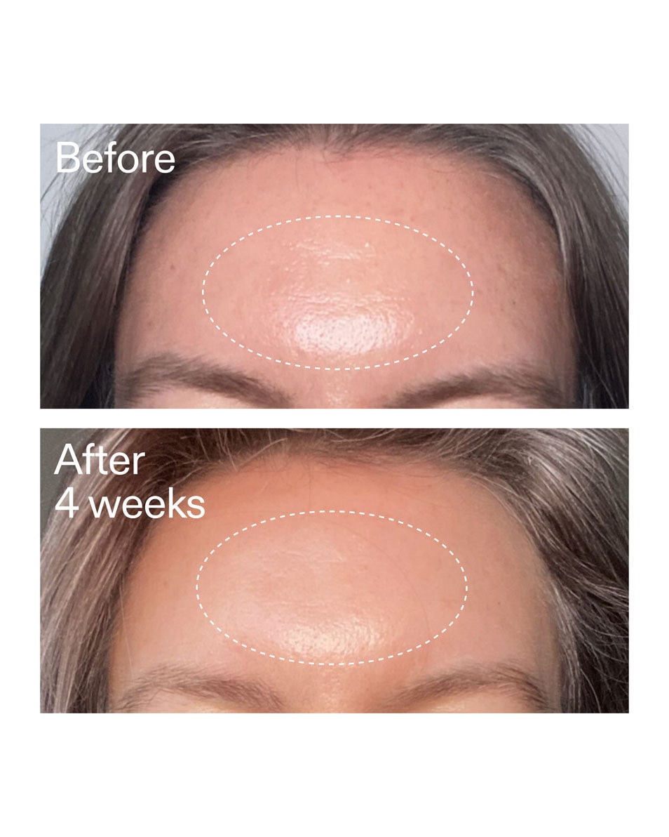 The Inkey List Advanced Retinal Serum Geavanceerd Retinal Serum 15 ML 4