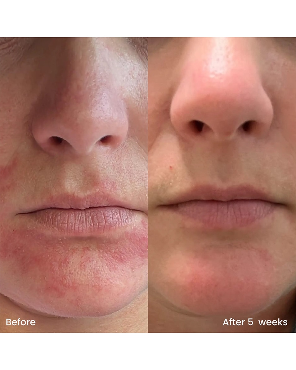 CLAY AND GLOW HYDRATING MOISTURIZER HYDRATERENDE DAG- EN NACHTCRÈME 75 ML 4