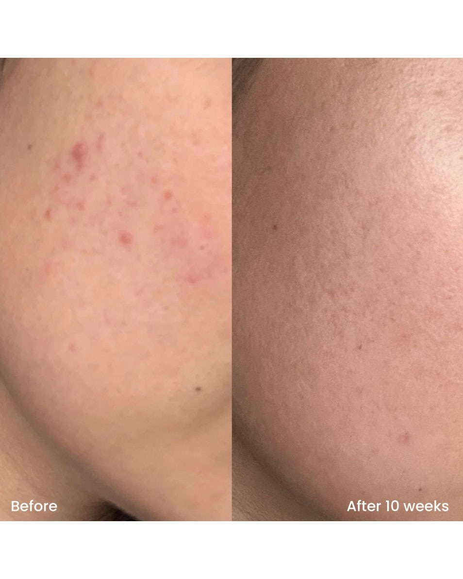 CLAY AND GLOW TRIPLE AHA STRAW-JELLY CLEANSER VERZACHTENDE REINIGINGSGEL 250 ML 3