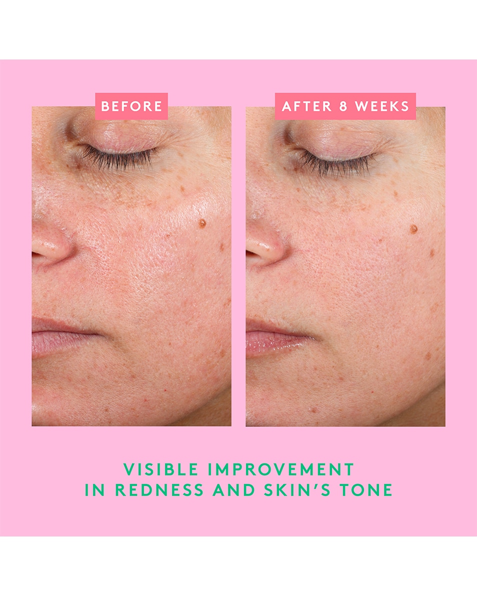 Borra Barrier™ Repair Cream