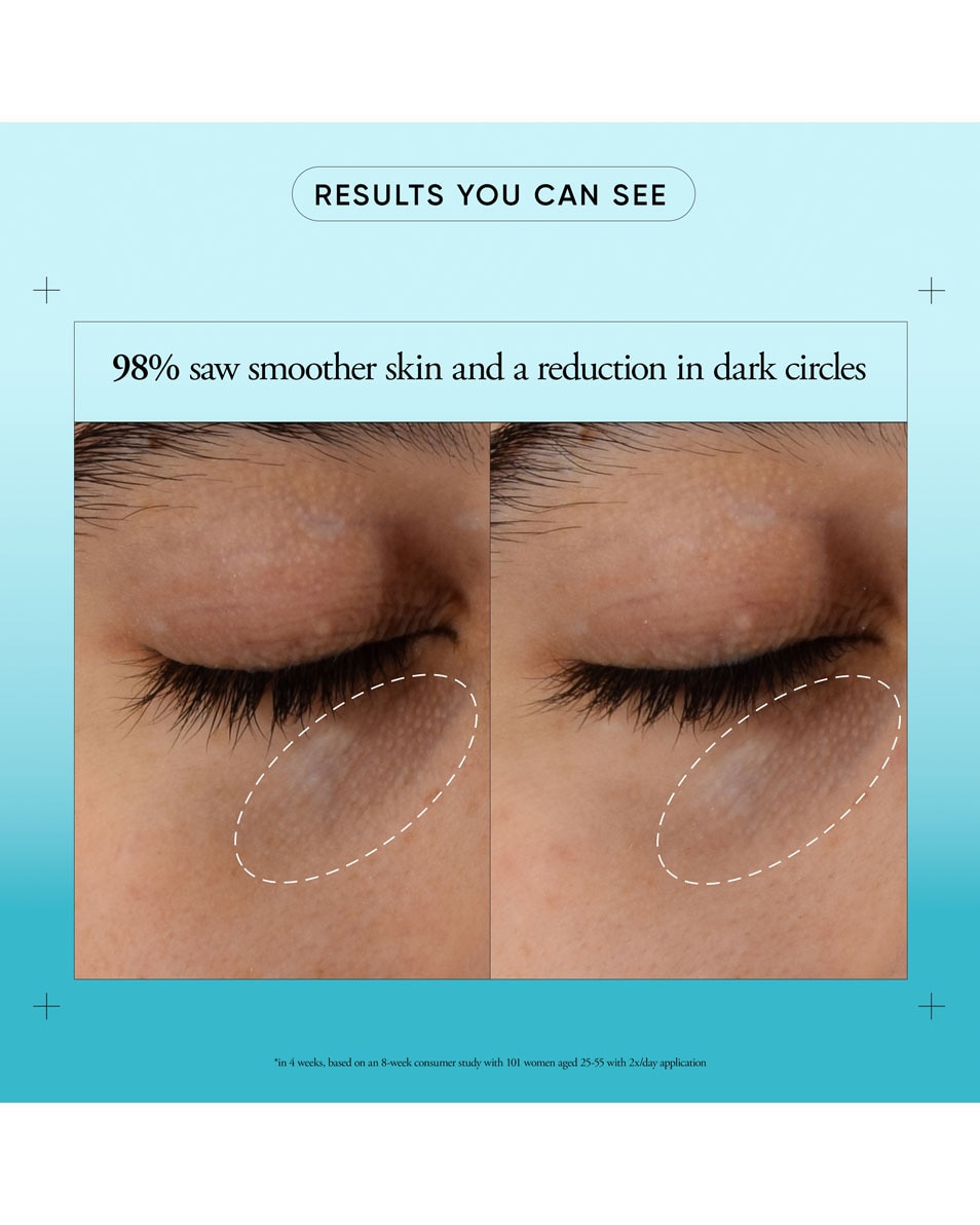 dark circle brightening oogcrème