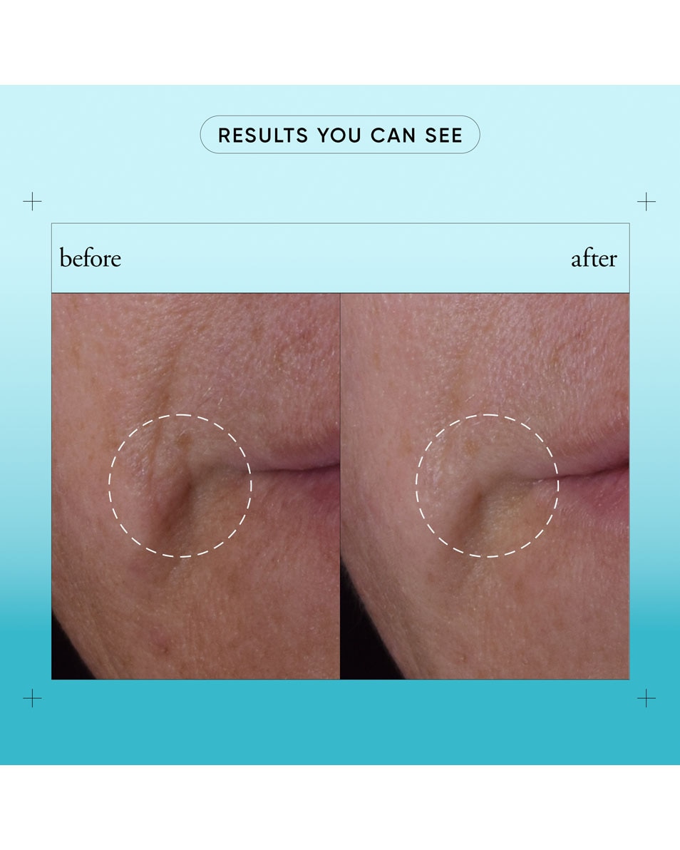 PHILOSOPHY dose of wisdom bouncy skin reactivating serum 30 ML 5