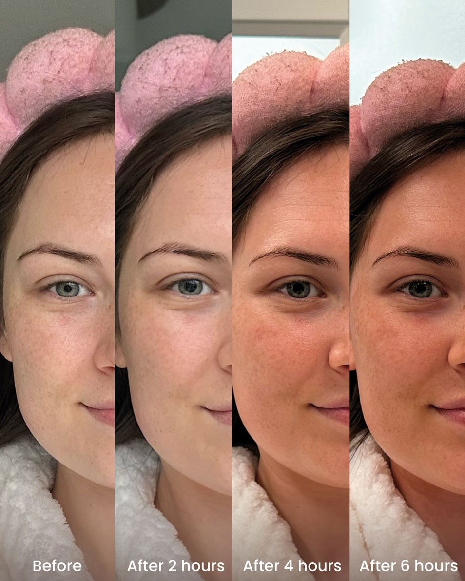 Hyaluronzuur Tanning Druppels