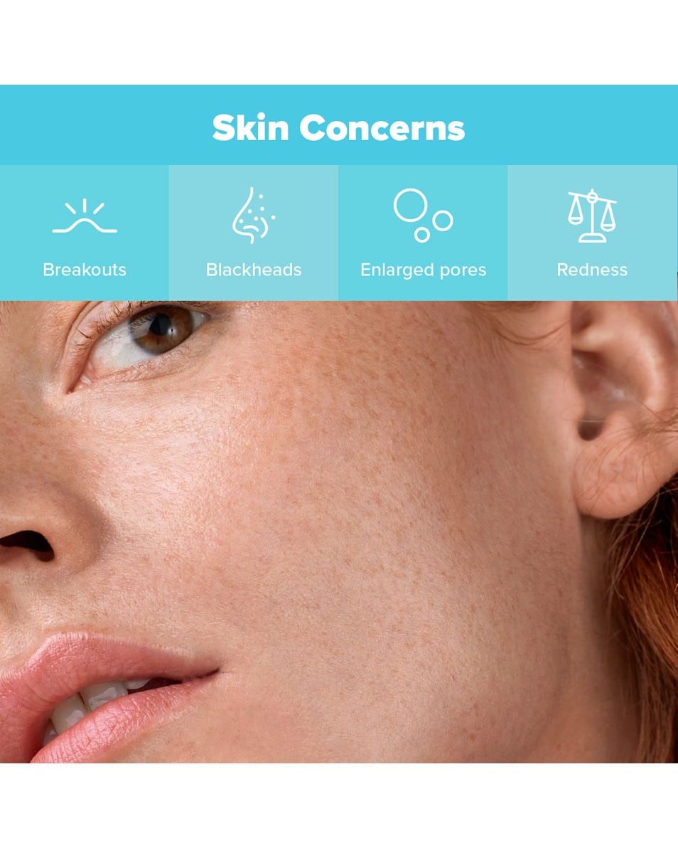 Paula's Choice MINI-KIT Eerste Hulp Bij Puistjes 3 ST