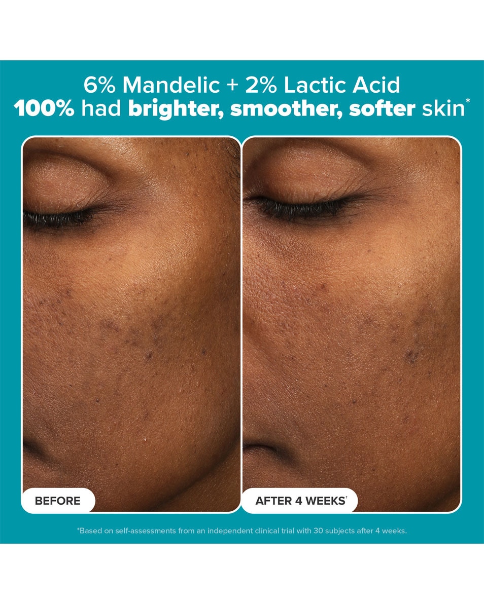 Paula's Choice MINI-KIT Multi-Level Exfoliatie 2 ST 5