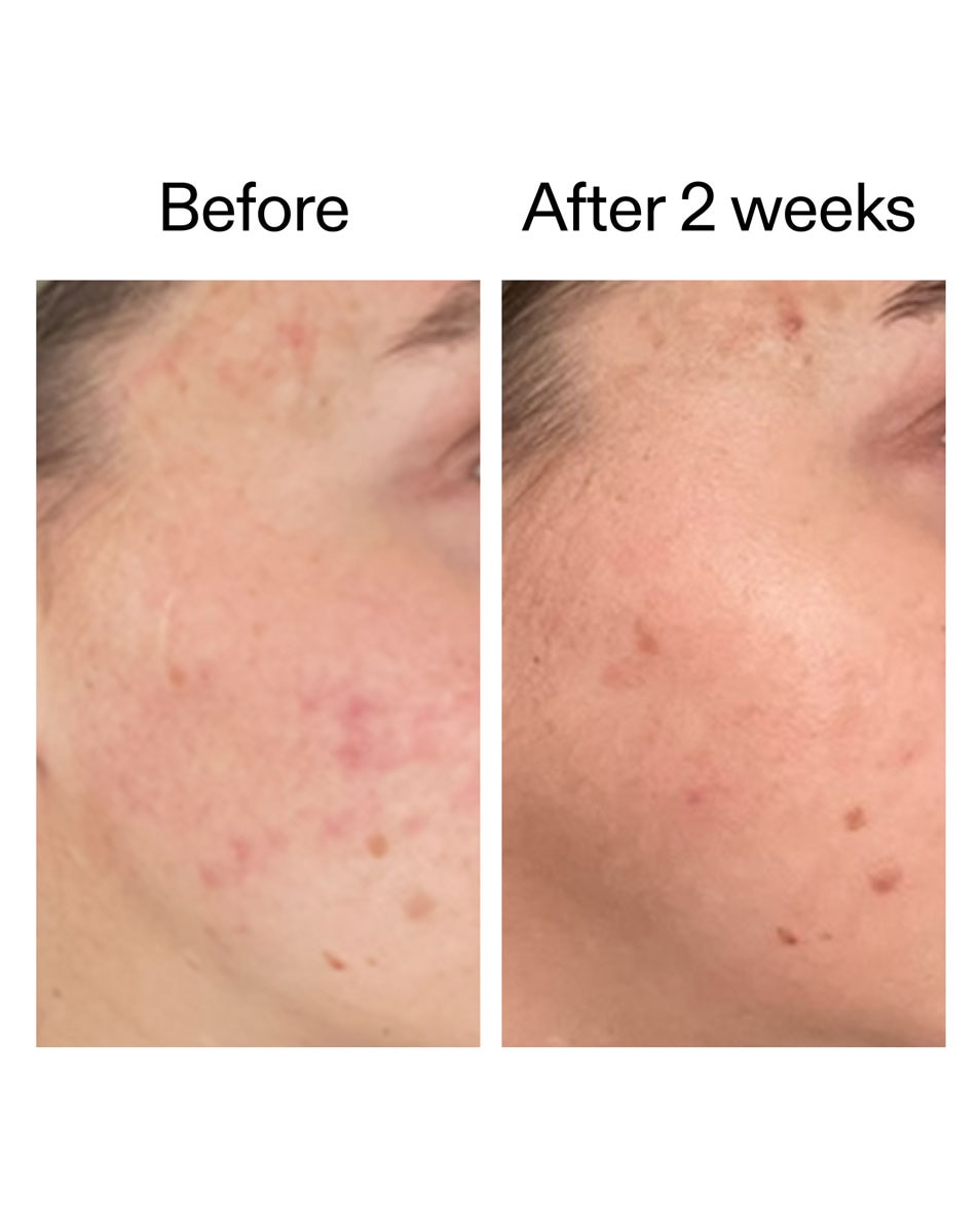 Coffret Soin Barrière Cutanée